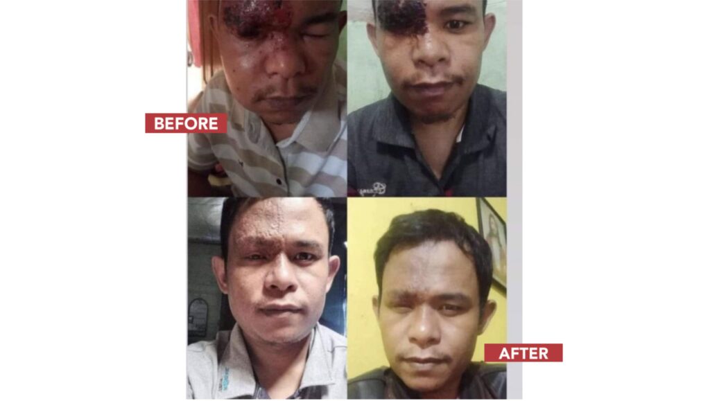 afc nutrisi samarinda