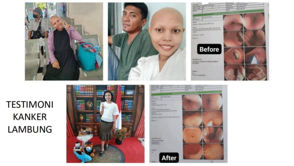 afc nutrisi samarinda
